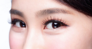 釘書機式雙眼皮好處:無需拆線恢復快!效果永久!