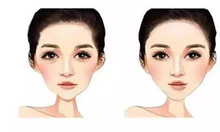 太陽穴凹陷影響面相?了解凹陷原因!專家揭太陽穴填充補救方法