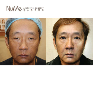 「技術更精進,服務更到位」「5D 環迴釘書機式雙眼皮」