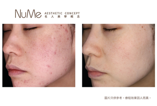 M22 Stellar進階星動光嫩膚