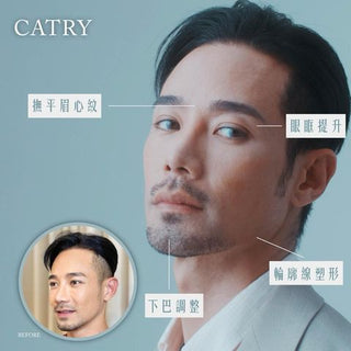 瘦面針療程 NEFERTITI瘦面秘技