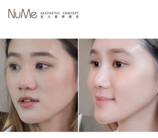 Cleviel 最高濃度鼻專用透明質酸