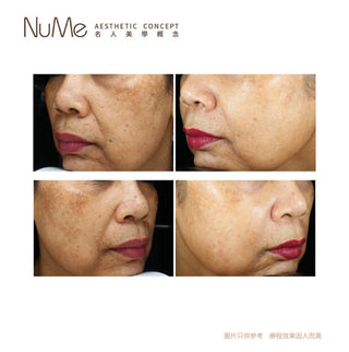 SylfirmX 第二代黃金矽谷電波