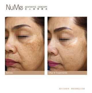 SylfirmX 第二代黃金矽谷電波