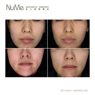 SylfirmX 第二代黃金矽谷電波