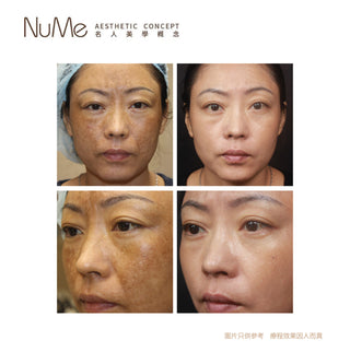 SylfirmX 第二代黃金矽谷電波