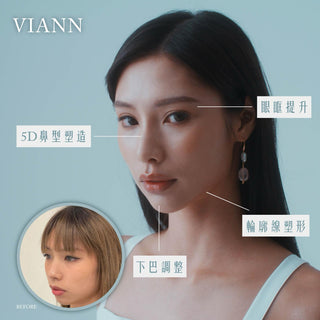 香港鼻王,打造黃金鼻例