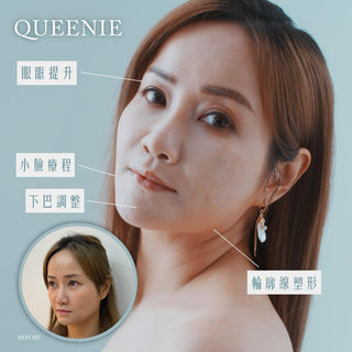 【醫生揭秘】90%的顏值問題,竟然都和「下巴」有關!