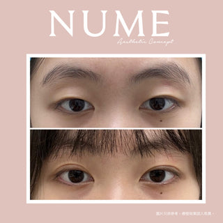 「技術更精進,服務更到位」「5D 環迴釘書機式雙眼皮」