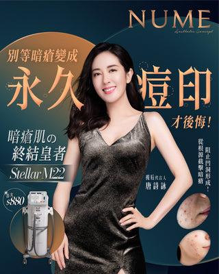 香港人必看!暗瘡停藥就復發?FDA認證M22 Stellar 專門KO暗瘡、消炎、去印、嫩膚