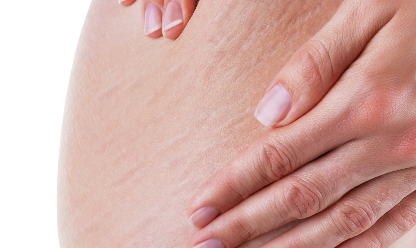 橙皮紋消除！磨沙敷橙皮有用嗎？2招拆解 （2026更新）