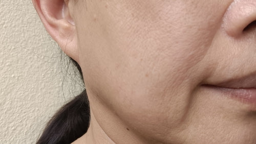 【木偶紋】與嘴邊肉有何關係？了解木偶紋出現原因及消除方法