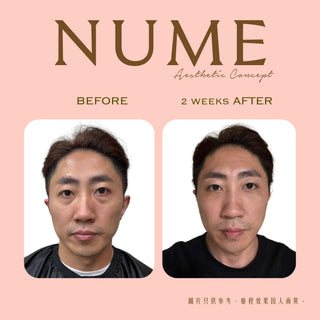 男人的眼袋，影響的不只是外表。30+成功男士必看。