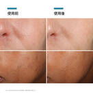SkinCeuticals｜ Phloretin CF 全能抗氧修護精華CF 30mL