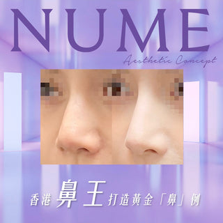 NuMe「香港鼻王」美鼻療程