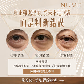 你以為自己有眼袋？其實，未必。｜高端眼周年輕感，從來不是填滿或抽走，而是判斷準確。