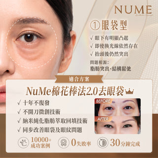 你以為自己有眼袋？其實，未必。｜高端眼周年輕感，從來不是填滿或抽走，而是判斷準確。