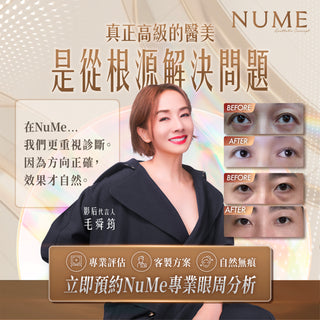 你以為自己有眼袋？其實，未必。｜高端眼周年輕感，從來不是填滿或抽走，而是判斷準確。