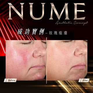 【告別紅黑，才是真白｜你不是不白，是底色太「雜」】