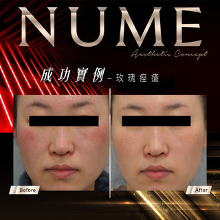 【告別紅黑，才是真白｜你不是不白，是底色太「雜」】