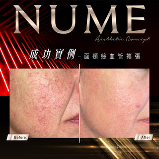 【告別紅黑，才是真白｜你不是不白，是底色太「雜」】