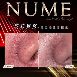 【告別紅黑，才是真白｜你不是不白，是底色太「雜」】