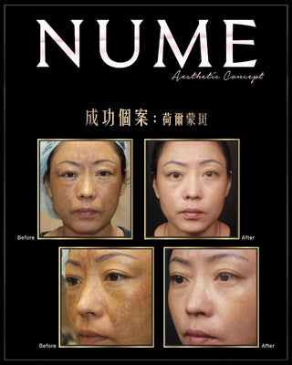 點解有啲人素顏唔算白，塊面卻永遠睇落好乾淨、好高級？