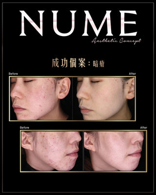點解有啲人素顏唔算白，塊面卻永遠睇落好乾淨、好高級？