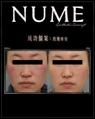 點解有啲人素顏唔算白，塊面卻永遠睇落好乾淨、好高級？